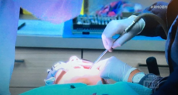 yolanda dentist fillings